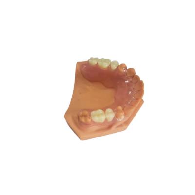 中国 3Dはデジタル データに基づいて歯科実験室のための総義歯を印刷した 販売のため