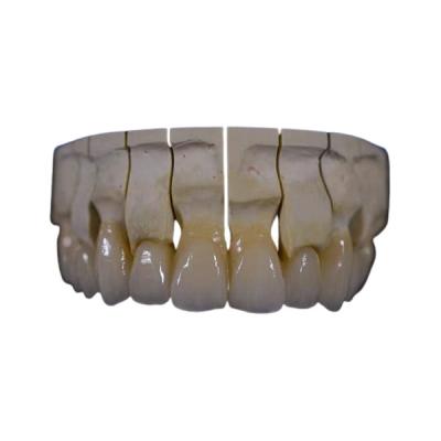 China A zircônia dental da restauração da coroa da zircônia completa da boca fixou a resistência química da ponte à venda