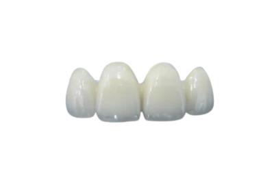 China Highly Biocompatible Zirconia Dental Crown Less Sensitive Abrasion Resistance for sale
