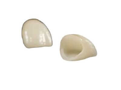 China Tamaño modificado para requisitos particulares colores hermosos realistas dentales de cerámica altamente biocompatibles de la corona en venta