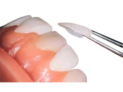 中国 歯科復帰のために耐久力のある注文OEMの歯科磁器のベニヤの会社 販売のため