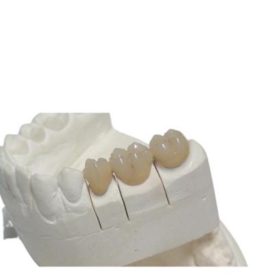中国 設計総義歯のカスタム化を印刷する一時的なCAD/CCAM PFMの歯科王冠3D 販売のため