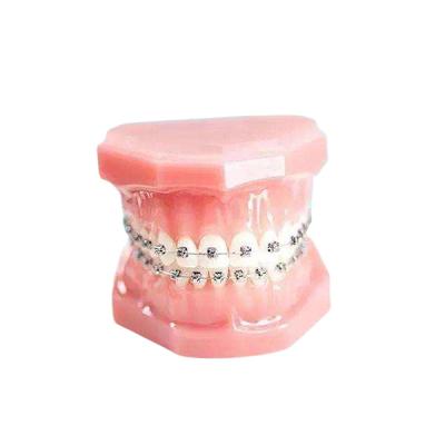 Chine Appareil fixe durable de parenthèse orthodontique extérieure lisse en métal à vendre