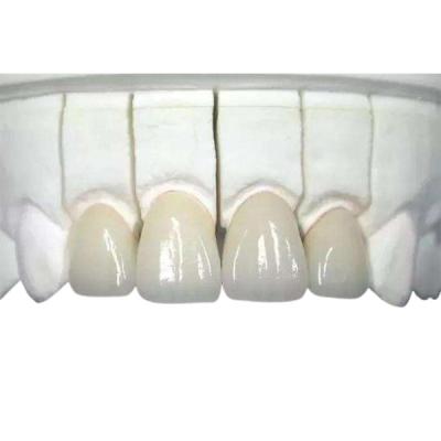 Chine 3D a imprimé biocompatible résistant à l'usure de couronne dentaire de zircone fortement à vendre