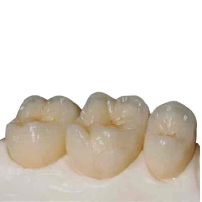 China High Strength Zirconia Ceramic Teeth Precision Digitally Manufactured for sale