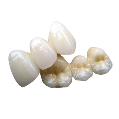 China Porcelain Bridge Crown Tooth Strong Stability None Foreign Body Sensation for sale