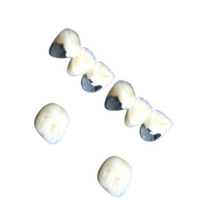 China Dientes dentales de la porcelana de Chrome del cobalto de la corona de la porcelana no alérgica resistentes a la corrosión en venta