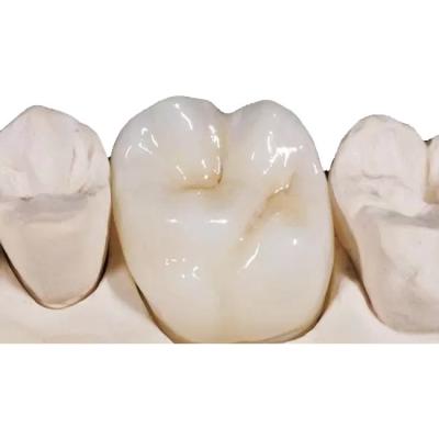 China White Porcelain Zirconia Dental Crown High Density Unobstructed for sale