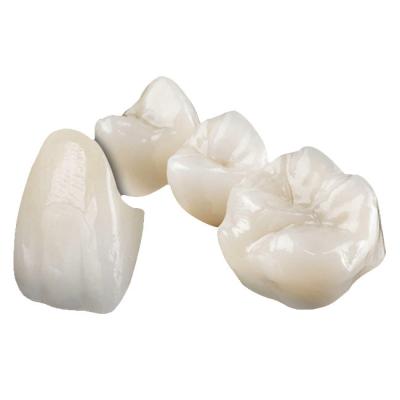 China Aesthetically Stable Zirconia Ceramic Crown Non Irritating Implant Crown for sale