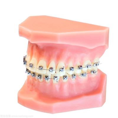 China Dental Braces Fixed Orthodontic Appliances Upgrade Soft Wire Brackets for sale