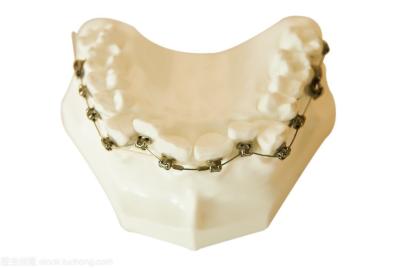 中国 歯科ブラケットの歯科材料の歯科矯正学は歯科矯正学の電気器具の用具を模倣する歯科矯正学の電気器具の歯を修理した 販売のため