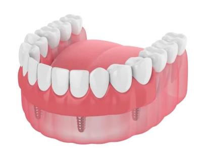 中国 本当の総義歯は歯の詰物の総義歯の一時的で取り外し可能な総義歯を逃す単一の全陶磁器の歯の総義歯を植え付ける 販売のため