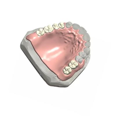 China Removable Dental Partial Denture Natural Color 3D Dental Model Customized for sale