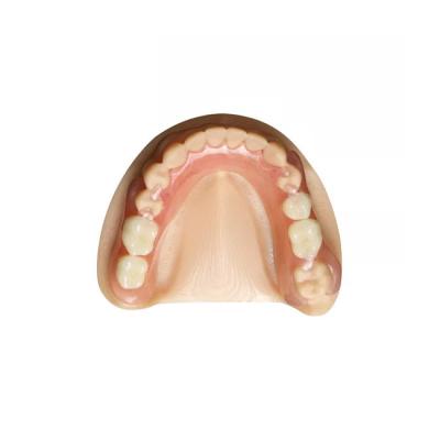 China Laboratorio dental profesional de las dentaduras removibles de la corona dental del zirconia en venta