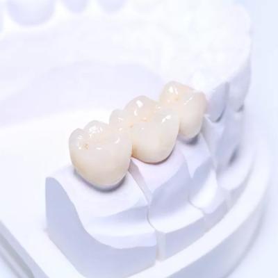 China Smooth Surface Removable Partial Dentures PFM Dental Bridge High Quality Assurance for sale