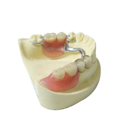 China Healthy Materials Denture Dental Lab Removable Partial Dentures custom made for sale