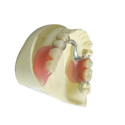 Chine Dentiers partiels démontables acryliques de laboratoire de dentier de produits dentaires dentaires de laboratoire à vendre
