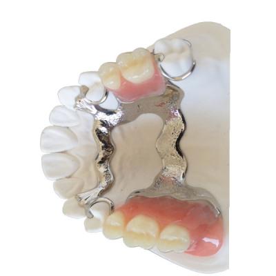 China FDA PFM Dental Bridge Good Biocompatibility 3D Printing Dental Models for sale