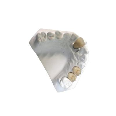 China Yellow Gold Porcelain Dental Crown Lab High Strength PFM Ceramic Crown for sale