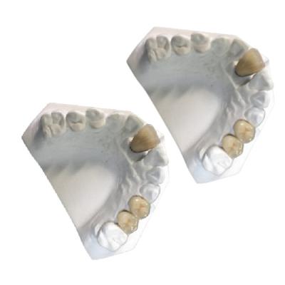 Chine Couronne dentaire de couronne de porcelaine de laboratoire de porcelaine dentaire d'or jaune à vendre