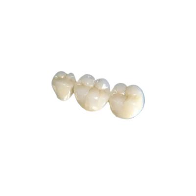 China Oral Hygiene Dental Crown Bridge Change Tooth Color Good Stability for sale