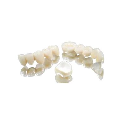 China Experience Dental Crown Bridge Metal Full Crown Double Ended Fixed Bridge Crown for sale