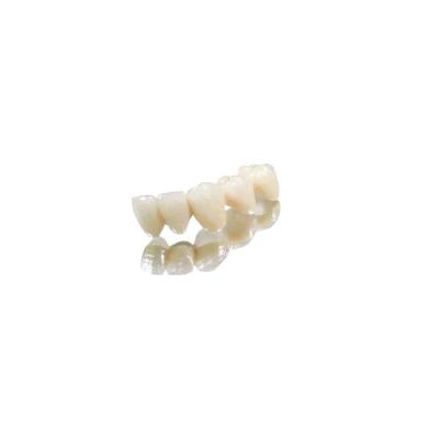 China Fit Properly Crown And Bridge Teeth Cobalt Chromium Full Metal Crown for sale