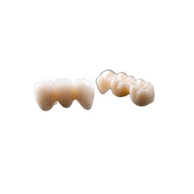 China Composite Fixed Bridge Crown Dental Crown Bridge Natural Color Good Stability for sale