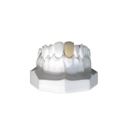 China Customized Porcelain Crowns Have A Real Appearance And Natural Color for sale