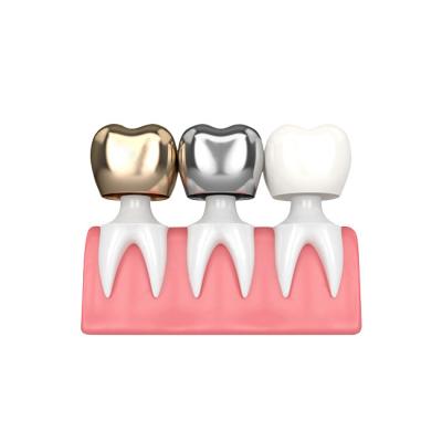China Good Biocompatibility Dental Crowns And Bridges Not Easy To Wear Color Stable for sale