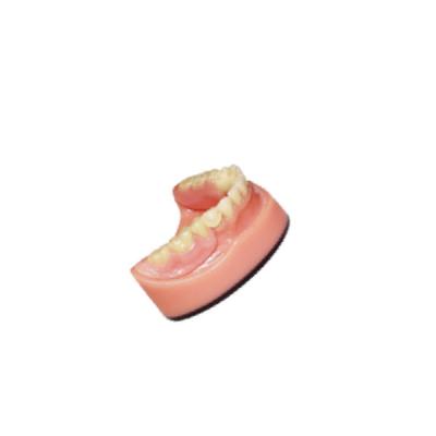 Chine Denture Dental lab PFM Dental Bridge 3D Digital Intraoral Scanning Imaging System à vendre
