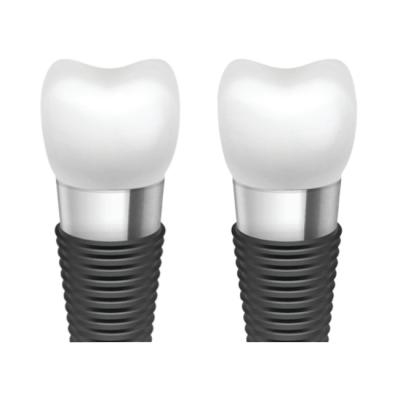 Chine Enhancing Oral Aesthetics With Dental Implant Bars à vendre