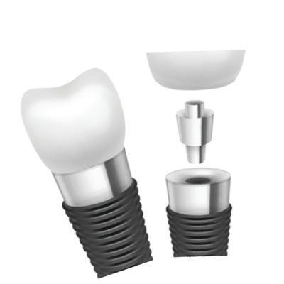 Chine Dental Implant Bars Material Innovation For Superior Performance à vendre