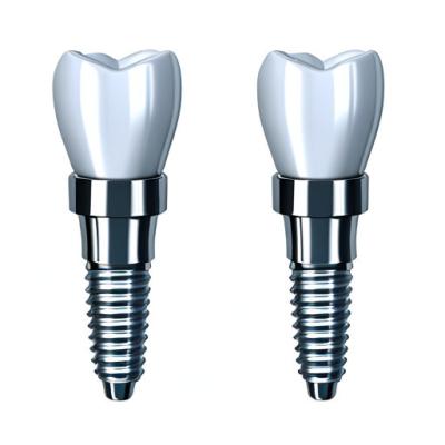 中国 Consistency In Every Crown Our Dental Implant Crown Manufacturing Process 販売のため