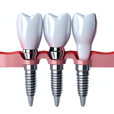 Chine Prioritizing Patient Satisfaction Our Commitment To Quality Dental Implant Crowns à vendre