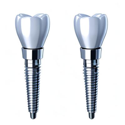 China Empowering Smiles The Life Changing Impact of Dental Implant Crowns for sale