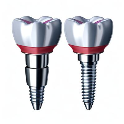 中国 The Perfect Fit Customization In Our Dental Implant Crowns 販売のため