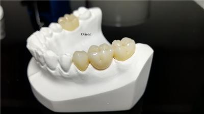 Κίνα Κεραμικά οδοντικά στεφάνια, Ζιρκόνια προς πώληση