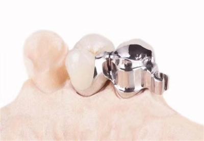 Chine Customized precision accessories for dental clinics à vendre
