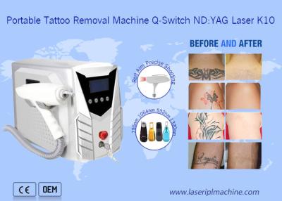 China Portable de la máquina del retiro del tatuaje del laser 1064nm/532nm con la manija desmontable en venta