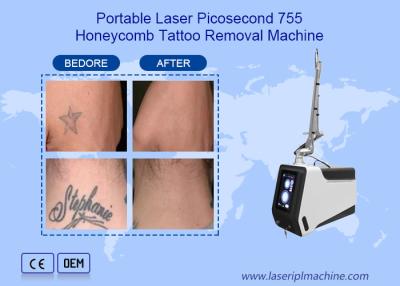 China Dispositivo 755nm 1064nm 532nm de la máquina del retiro del tatuaje del laser del picosegundo del Nd Yag en venta