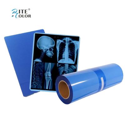 China IMATEC Blue PET Inkjet Medical CR X-Ray Radiography Film For Canon Printers for sale