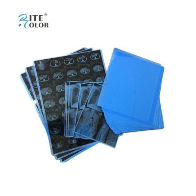 China Inkjet Printing PET Blue Medical Film For X Ray A4 8x10 14x17 Sheets for sale