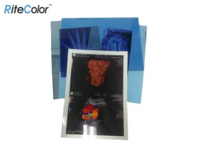 China Película seca de la proyección de imagen médica de Digitaces para la película médica azul 210mic del chorro de tinta del ANIMAL DOMÉSTICO de X Ray en venta