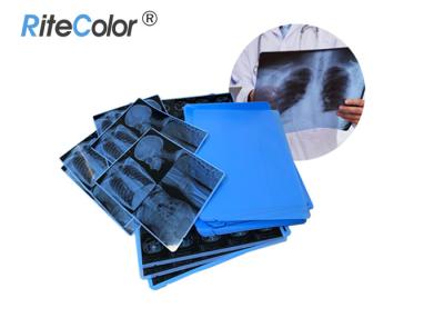 China Película seca médica de la proyección de imagen de la película de hoja de la impresión por láser X Ray del chorro de tinta grueso de 210 micrones en venta