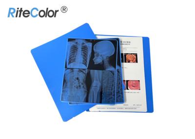 China Película de la proyección de imagen médica de A4 X Ray peso de gramo de 280 G/M para la impresión del chorro de tinta de Canon Epson en venta