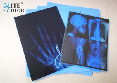 China Low Fog Blue PET Inkjet Medical Imaging Film 8 x 10 Inch For Epson Printer for sale