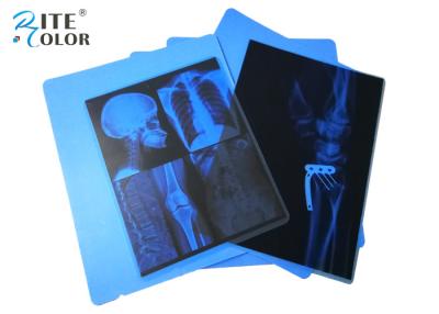 Κίνα Inkjet PET ιατρική ταινία ακτίνας X απεικόνισης μπλε για τους εκτυπωτές της Canon Pixma προς πώληση