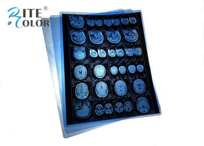 China Waterproof PET Blue Medical X Ray Film For MRI CT CR Dental Panorama Images Output for sale