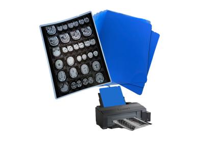 China 210um 8x10 A3 A4 Blue Medical Inkjet Film For Radiology X-Ray Imaging Output for sale